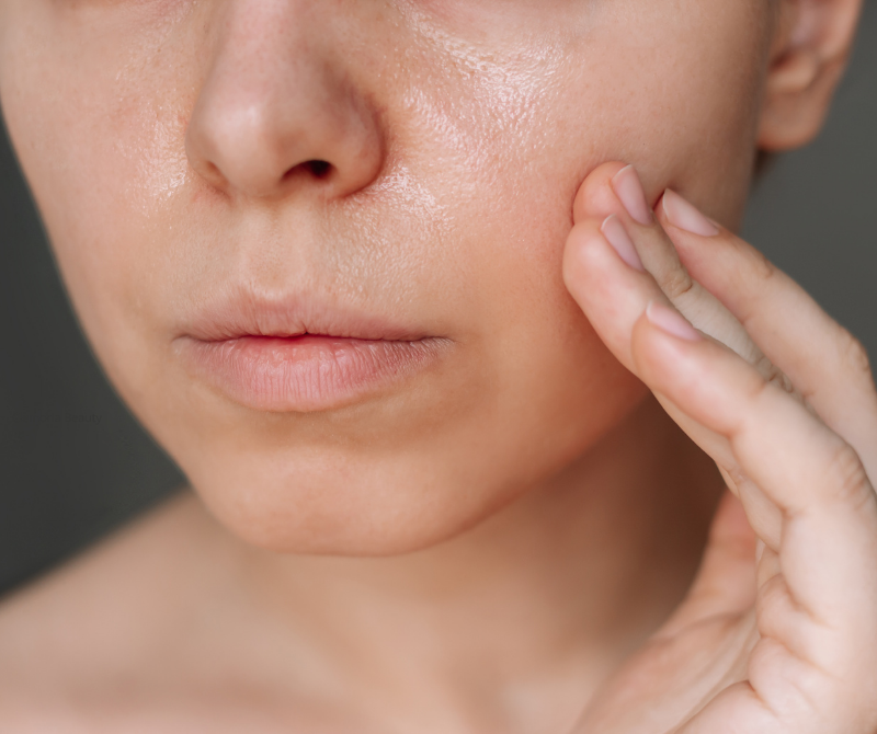 Peau grasse chez la femme