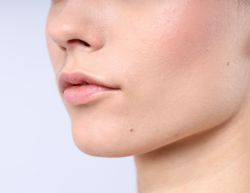 Peau normal chez la femme