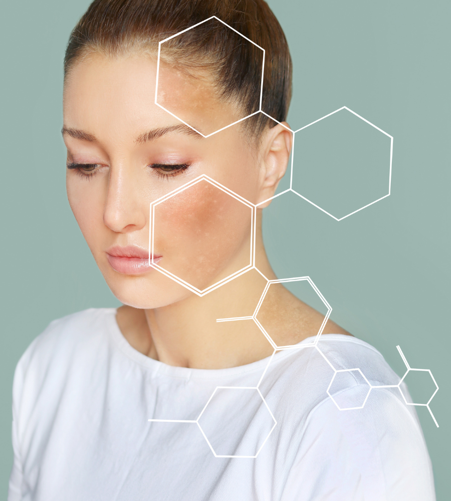 Analysez votre peau grâce au prompt gratuit