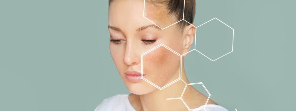 Comment analyser sa peau